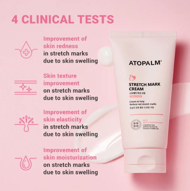 ATOPALM Stretch Mark Cream 150ml